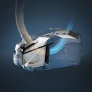 Unglaubliche Filtrierung