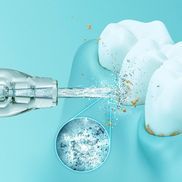 Ultraschalltechnologie füreine optimierte Mundpflege