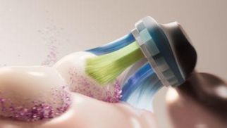 Verabschieden Sie sich von Plaque