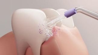 2er Pack USB Ladekabel Für Philips Sonicare Power Flosser 3000 – 1 Meter, Kompatibel Mit HX3826/21/23/24 – Ersatzkabel Für Zuhause & Unterwegs