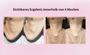 Intelligenter Timer & tragbar–Hautpflege jederzeit & überall