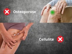 Kann gegen: Osteoporose und Cellulite helfen 