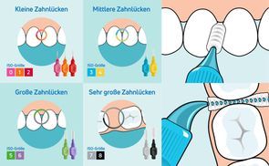 Mundgesundheit fördern