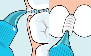 Gründliche Reinigung