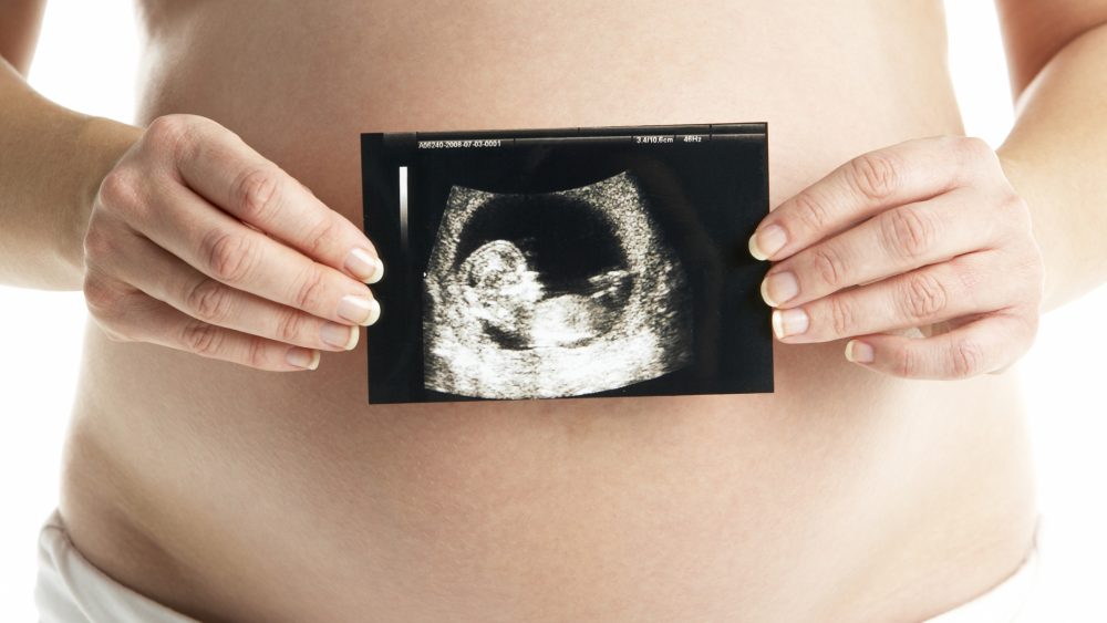 Babybauchfoto Ultraschallbild Frontalansicht