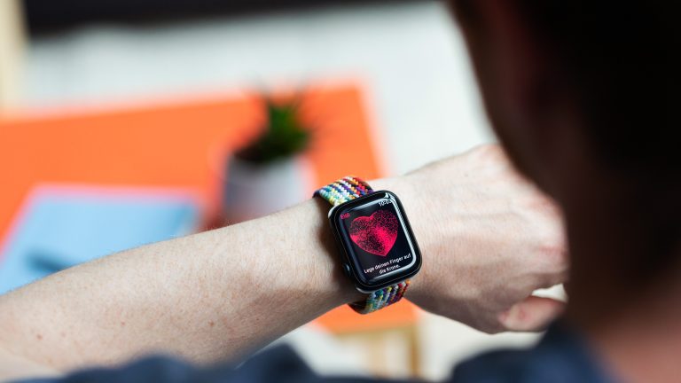 Eine Person trägt eine Apple Watch am Handgelenkt. Auf der ist das EKG zu sehen.
